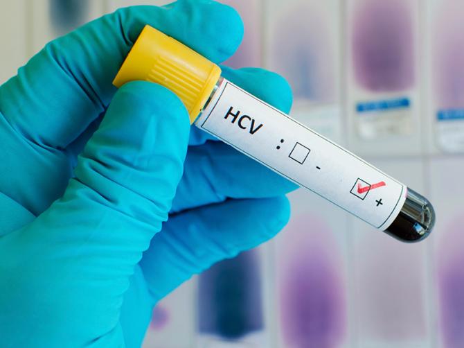 Новость - События - Полтавчан бесплатно проверят на гепатит С