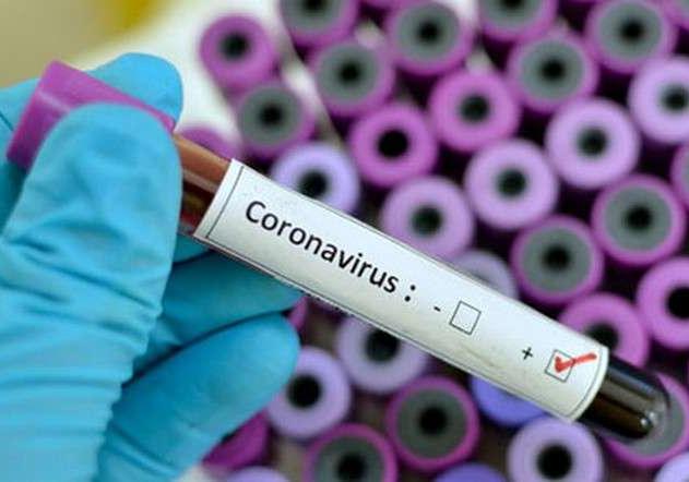 В Полтаве нет тест-систем для выявления коронавируса