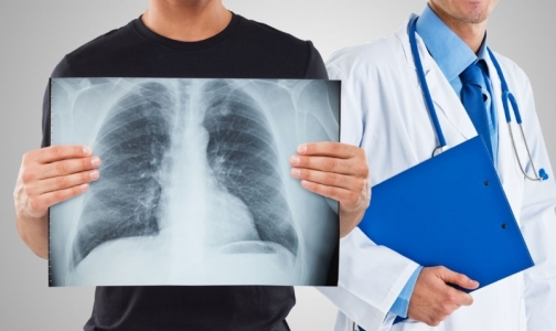 В марте будет работать бесплатный передвижной флюорограф. Адреса