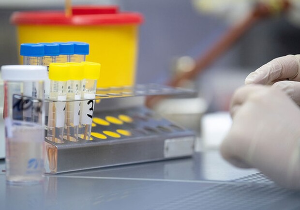 На Полтавщине запускают еще 7 иммуноферментных лабораторий