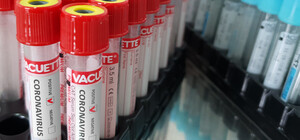 Полтавский лабораторный центр не справляется с наплывом анализов COVID-19: платные исследования временно отменили