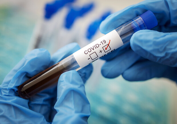 За сутки в Полтавской области 28 человек заболели коронавирусом