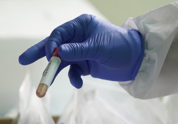 В Полтаве за сутки 1 человек умер с диагнозом коронавирус
