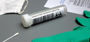 Где можно бесплатно сделать тест на Covid-19 в Киеве: Адреса