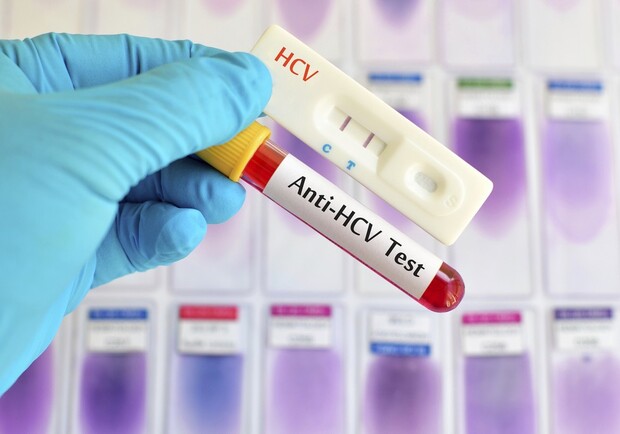 В Полтаве проведут бесплатное тестирование на гепатит С. Фото:https://life4me.plus/