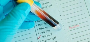 Возле жд вокзала Одессы будут анонимно тестировать на ВИЧ, сифилис и гепатиты