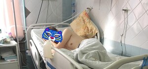 Подростку, который сбежал из дома в Одессе и получил обморожение, ампутировали ноги