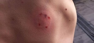 На одесском Привозе наркоман-вампир покусал людей до крови