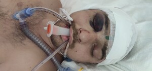 В Одессе ищут родственников велосипедиста, пострадавшего в ДТП (обновлено)