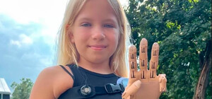 9-летней Саше, потерявшей руку во время обстрелов Бучи, установили протез