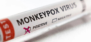 В Украине зафиксировали третий случай оспы обезьян 