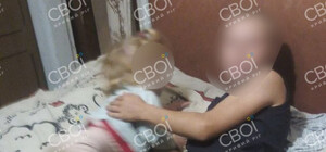 В Днепропетровской области в руках у ребенка взорвалась батарейка