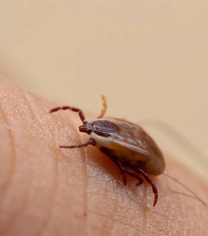 Как безопасно вытащить клеща: пошаговая инструкция, профилактика и советы