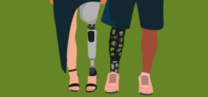 У Харкові вперше провели остеоінтеграційне протезування для людей із високими ампутаціями