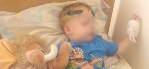 В Одесской области работник ТЦК наехал на двухлетнего ребенка: подробности аварии