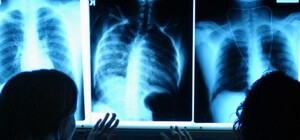 В Симферополе до 24 апреля будет работать передвижной флюорограф: где и когда