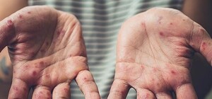 Массовое заболевание в СИЗО Симферополя: объявлен карантин