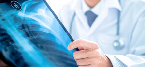 Где в августе в Киеве можно бесплатно пройти флюорографию. Адреса