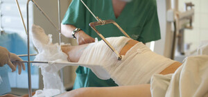 Винят врачей в халатности: под Харьковом умер парень со сломанной ногой