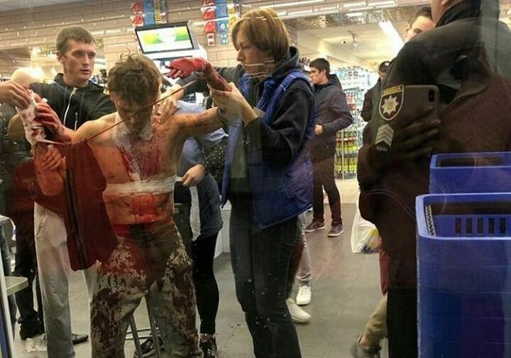 В Полтаве окровавленный парень забежал в супермаркет