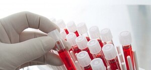 Киевлян приглашают бесплатно пройти тест на ВИЧ: адреса