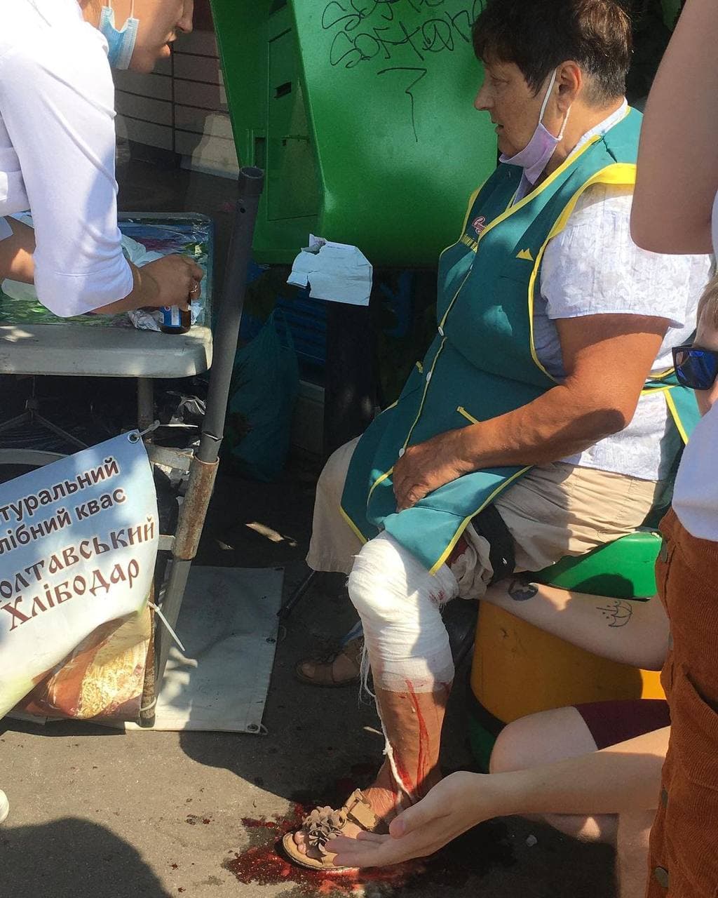 Женщине разрезало ногу. Фото: poltava shosho