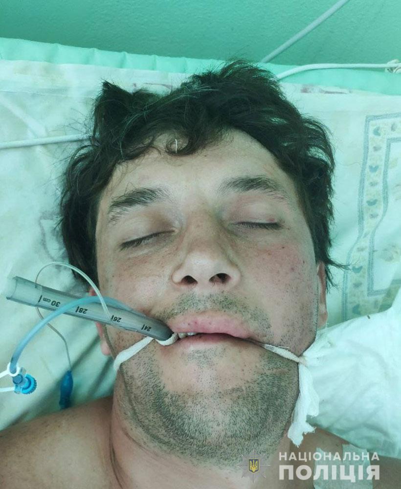 Пострадавший мужчина. Фото: pl.npu.gov.ua/