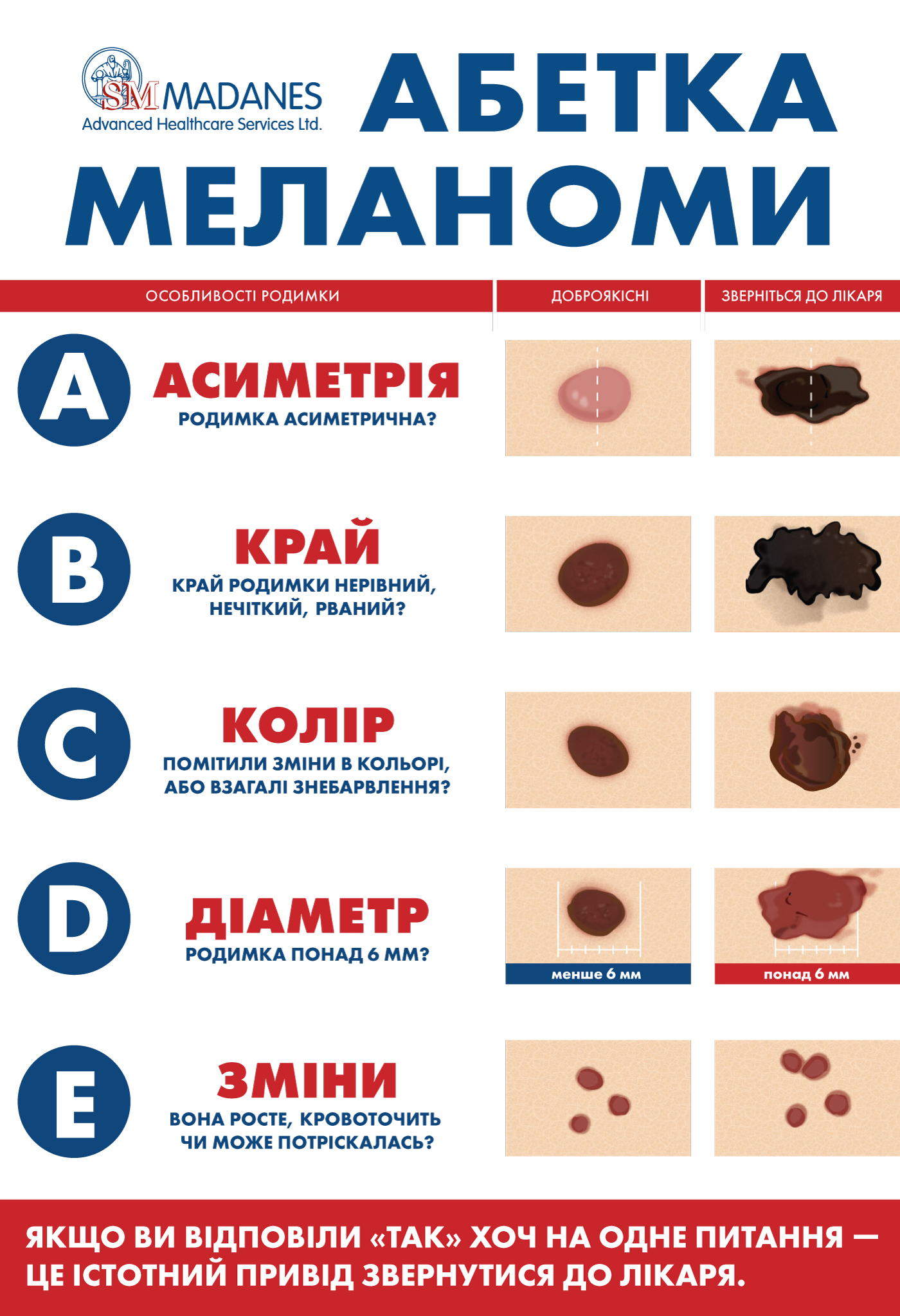 Каждый 20 украинец может болеть меланомой и не знать об этом фото 1